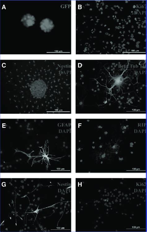 Neural Stemprogenitor Cells Nspcs Isolated From The Subventricular