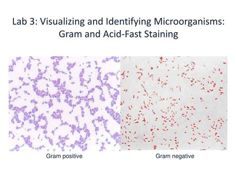 Ppt Lab 3 Visualizing And Identifying Microorganisms Gram And Acid
