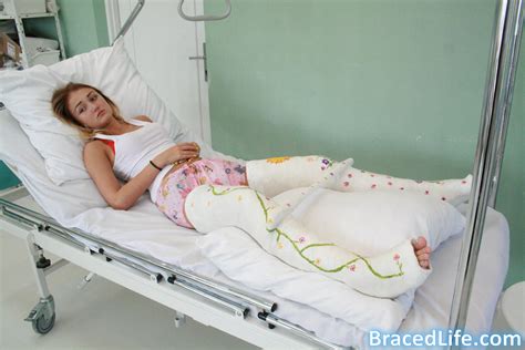 Bettys Double Long Leg Plaster Casts 4 By Medicbrace On Deviantart