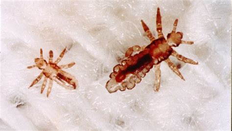 Super Lice Are In Iowa Heres How To Treat Them