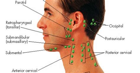 Lymph Nodes Of The Head And Neck Smarts Health Pinterest Lymph