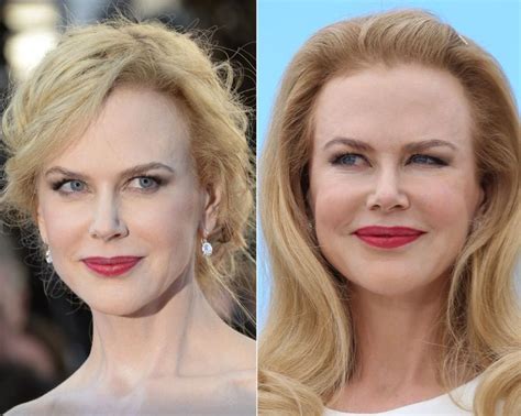 Nicole Kidman Before And After