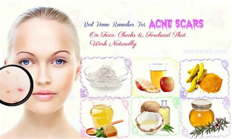 Laser treatments and prescription creams are targeted to help fade them, sure, but the dollars signs add up quickly. Home Remedies For Acne Scars : Turmeric For Acne - B20masala