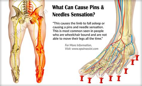 Cancer Pins And Needles Sensation Cancerwalls