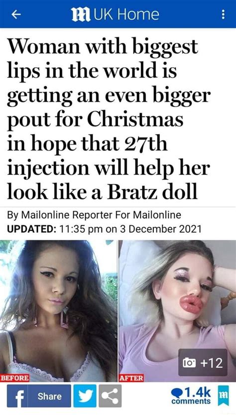 Uk Home Woman With Biggest Lips In The World Is Getting An Even Bigger Pout For Christmas In