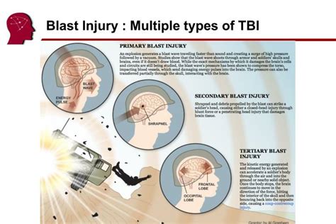 Ppt Glial Responses To Tbi Powerpoint Presentation Id3595233