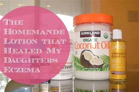 The Homemade Lotion That Healed My Daughters Eczema — Mommys Dressing Room