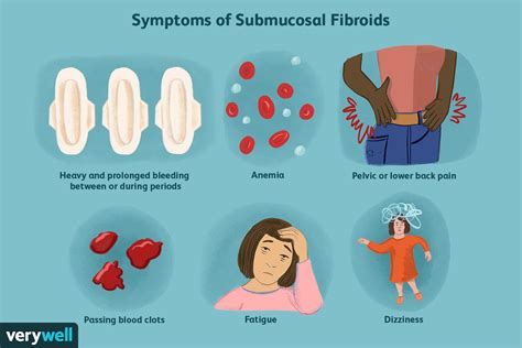 Submucosal Fibroids Symptoms Causes And Treatment