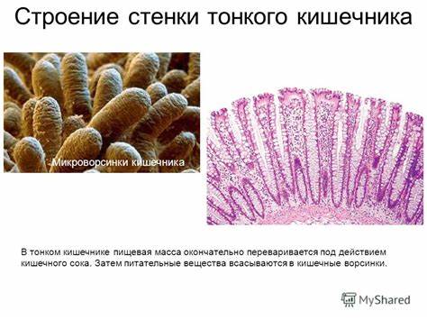Заболевание толстого кишечника диета Презентация на тему: "Строение и функции пищеварительной системы Презентация на тему: "Строение и функции пищеварительной системы Заболевание толстого кишечника диета