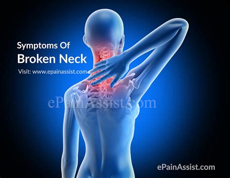 Broken Neck Treatment Physical Therapy Recovery Symptoms Causes