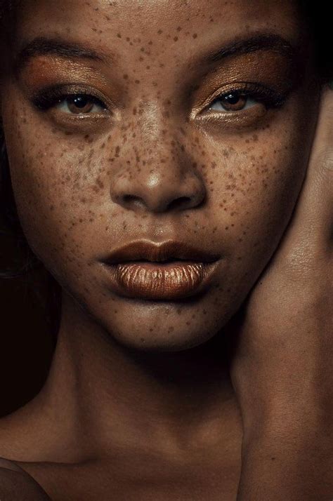 ﾟcolors By Miaღ・ﾟ On Twitter Black Girls With Freckles Freckles