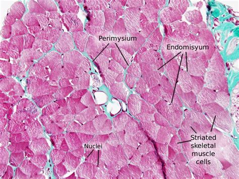 Skeletal Muscle Tissue Histology