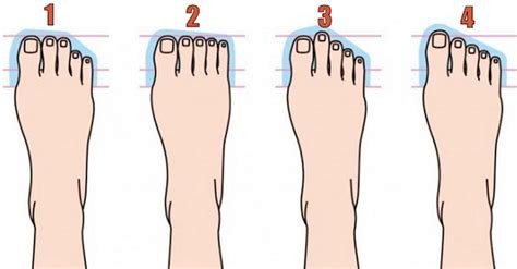 Do Your Feet Look Like Any Of These That Means You Have This Type Of