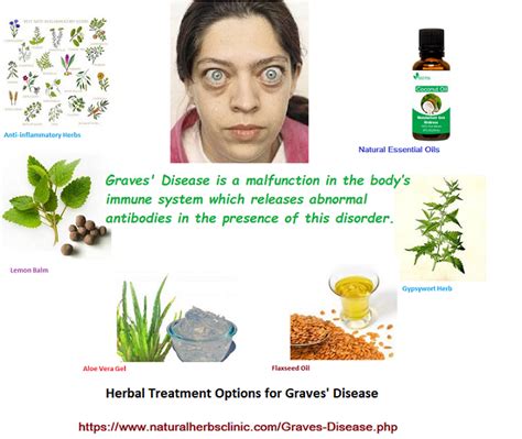 Relationship between graves' ophthalmopathy and type of treatment of graves' hyperthyroidism. Graves' Disease Natural Treatment | Natural Herbs Clinic