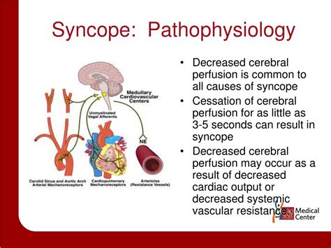 Ppt Syncope Evaluation And Management Powerpoint Presentation Free