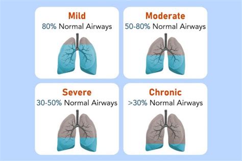 An Information Guide To ‘chronic Obstructive Pulmonary Disease