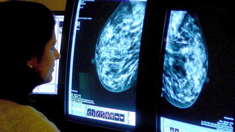 Personalised Dna Blood Test Could Help Track Early Stage Breast Cancer
