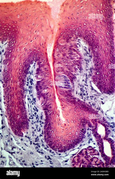 Taste Bud Coloured Light Micrograph Of A Section Through The Tongue