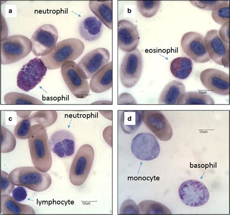 The Five Different Types Of Leukocytes Or White Blood Cells Of P