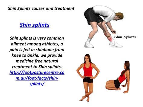 Ppt Shin Splints Causes And Treatment Powerpoint Presentation Free