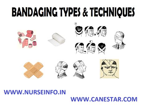 Bandaging Nursing Procedure Nurse Info