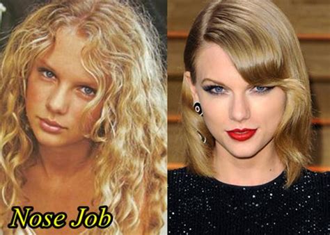 Taylor Swift Plastic Surgery Before And After Nose Job Boob Job