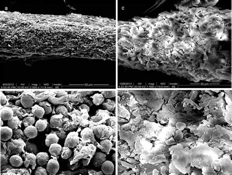 Human Skin Cell Under Electron Microscope Micropedia