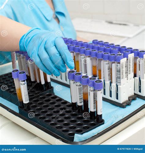 Test Tubes With Blood In Laboratory Stock Photo Image Of Hold Haemal