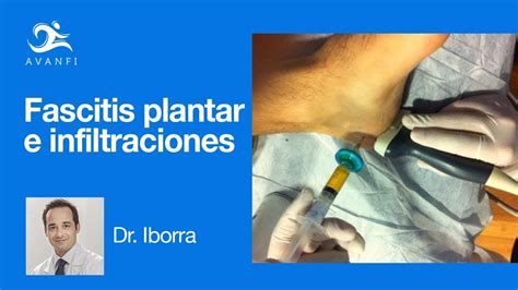 Infiltraciones Para La Fascitis Plantar Podología Dr Iborra Youtube