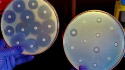 How Fungi Kill Millions Globally Aspergillus And Aspergillosis