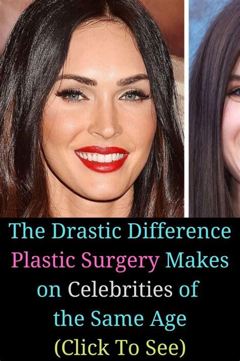 The Drastic Difference Plastic Surgery Makes On Celebrities Of The Same