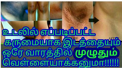 Here are some body parts names. permanent remedy for black patches in body Tamil/how to ...