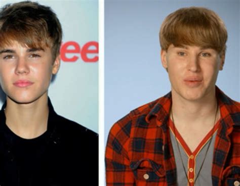 Justin Bieber Look Alike From Most Interesting Patients On Botched E