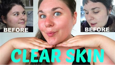 How To Get Glowing Clear Skin Naturally And Vegan Youtube