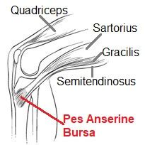 Pes Anserine Bursitis Causes Treatment Knee Pain Explained