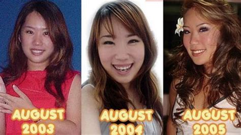 We hope that you can overcome this and recover from your surgeries, and emotional and physical distress soon. Media Culture: Artifical Beauty