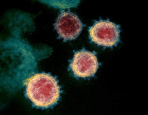Novel Coronavirus Structure Reveals Targets For Vaccines And Treatments