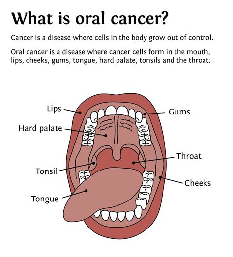Pin On Oral Hygiene