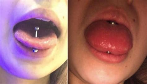 tongue piercing swelling causes and treatment authoritytattoo