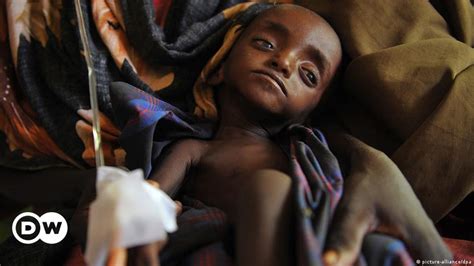 14 Millionen Kinder Vom Hungertod Bedroht Dw 21022017