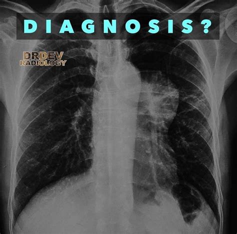Dr Dev On Instagram “what Is Your Diagnosis Anterior