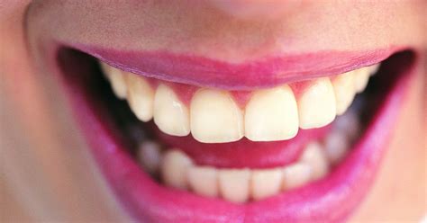 The definitive guide to straighten teeth without braces. Diez consejos para cuidar tus dientes | eHow en Español