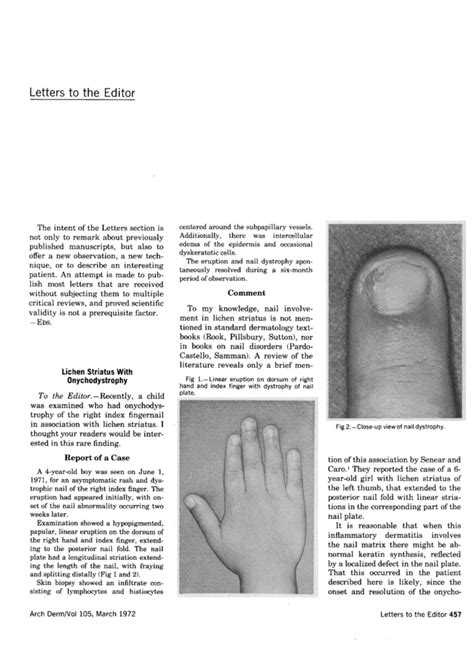 Lichen Striatus With Onychodystrophy Jama Dermatology Jama Network