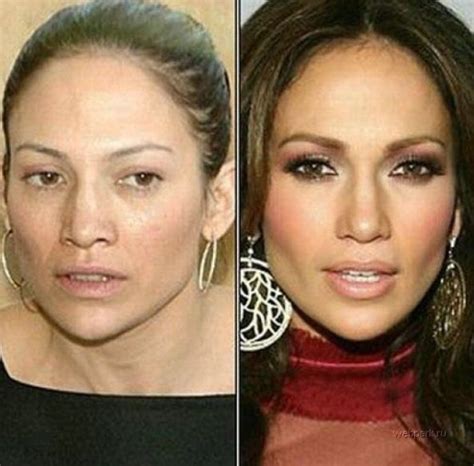 Jennifer Lopez Before And After Plastic Surgery 04 Celebrity Plastic