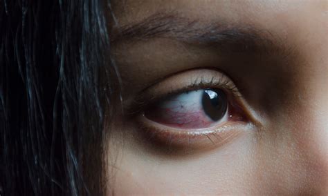 Heres Why Smoking Weed Makes Your Eyes Red The Fresh Toast