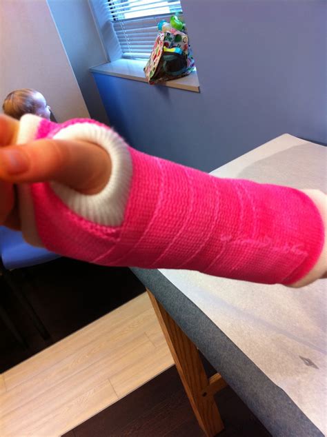 How To Take A Cast Off At Home - The Trials of Big J & Little J: We Now Have a Pretty Pink Cast