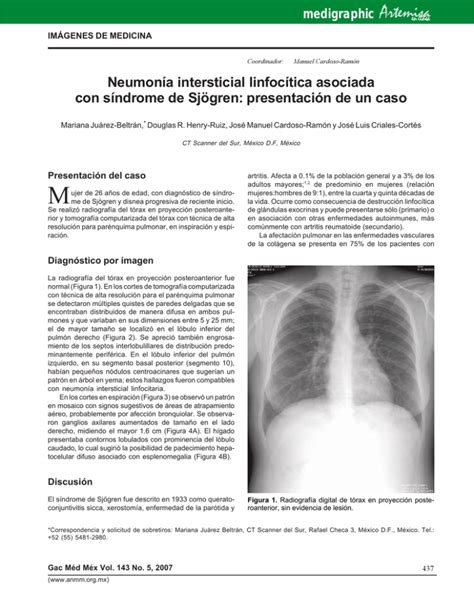 Neumon A Intersticial Linfoc Tica Asociadacon S Ndrome De Sj Gren