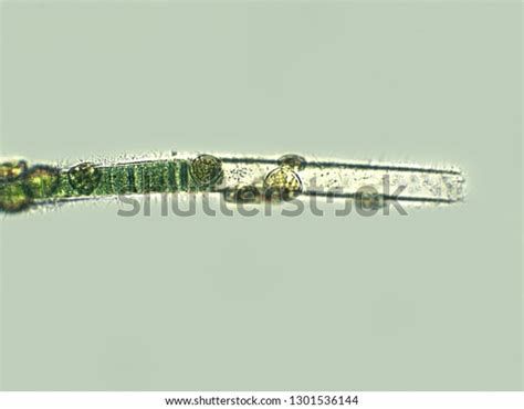 Blue Green Filamentous Algae Under Microscopic ภาพสต็อก 1301536144
