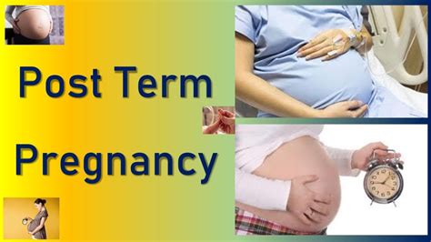 Post Term Pregnancy Postdated Pregnancy Causes Complications