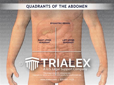 Quadrants Of The Abdomen Illustration Trialexhibits Inc